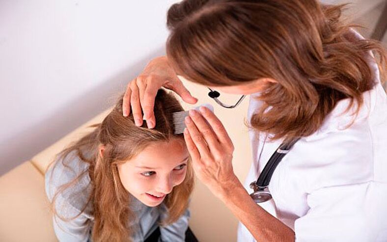liječenje psorijaze glave u djece